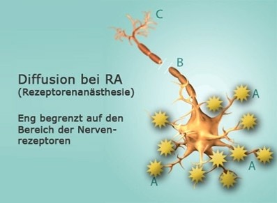 Diffusion in receptor anesthesia: tightly confined to the nerve receptor area